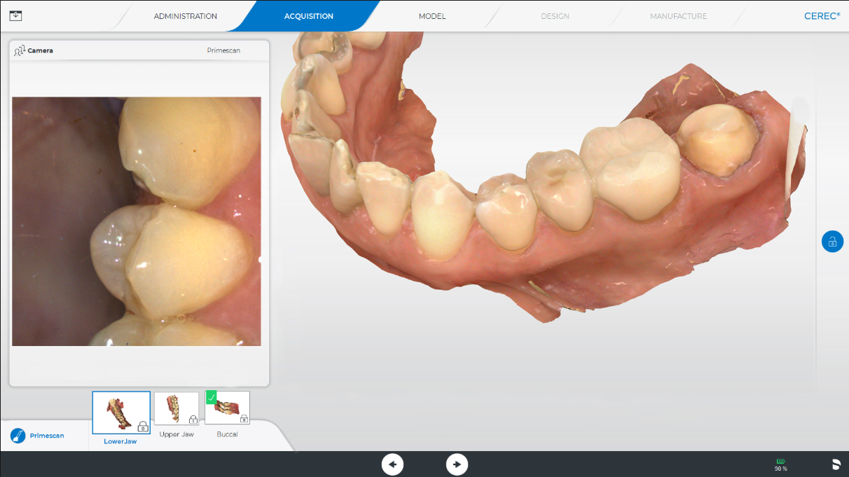 CEREC By Dentsply Sirona – Dental CAD-CAM